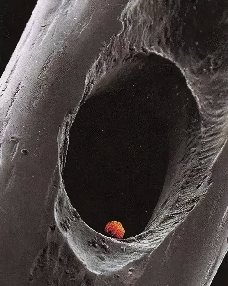 都不敢用力上厕所了，移植后的胚胎会流出来？