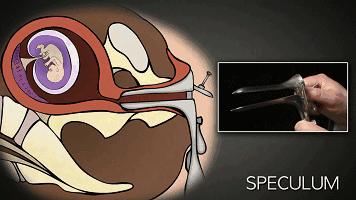 25岁的女生有几次打胎,女子堕胎6次连医生都惊讶了
