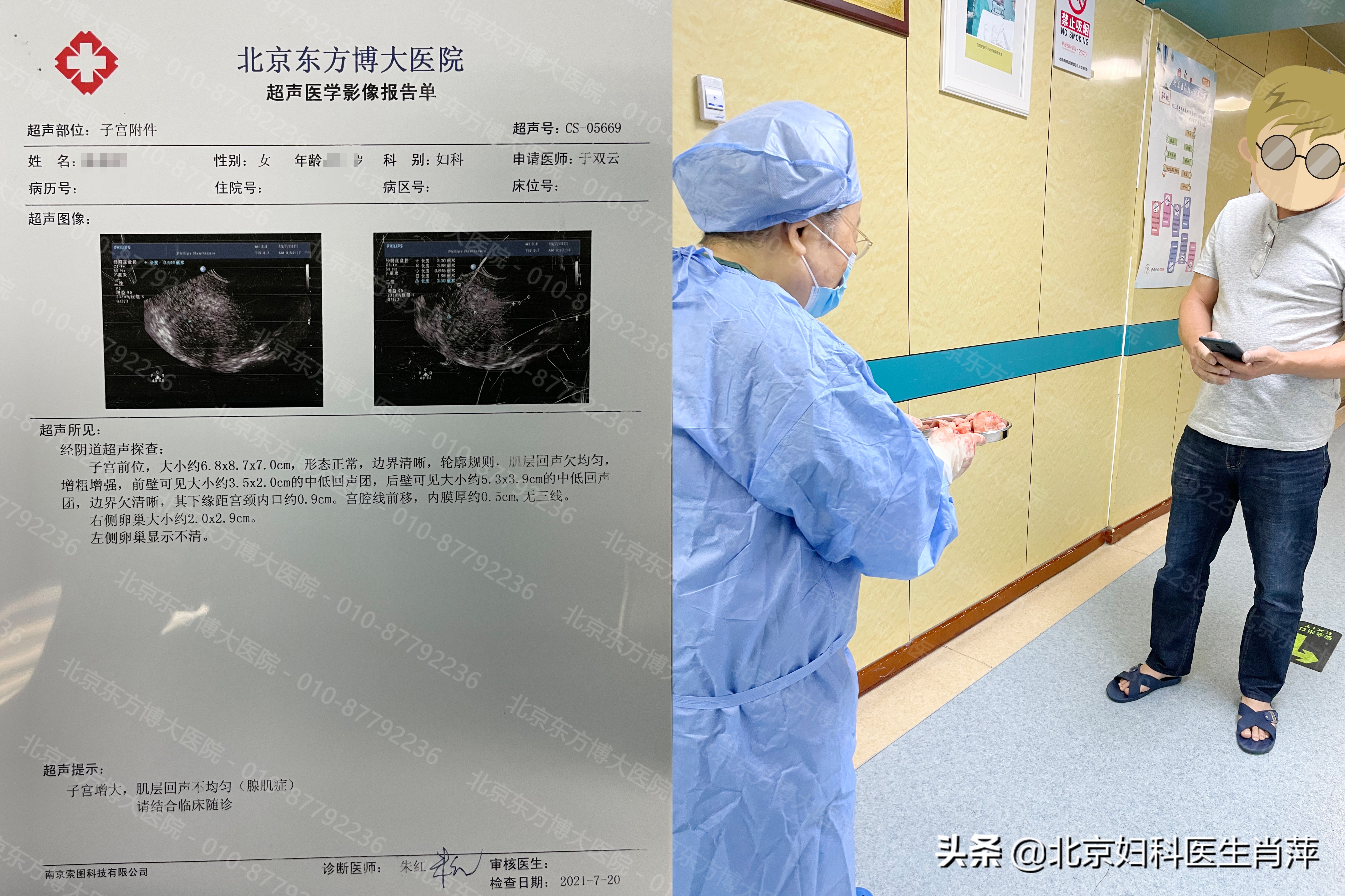 腺肌症北京哪个大夫能治疗,孙爱达医生腺肌症