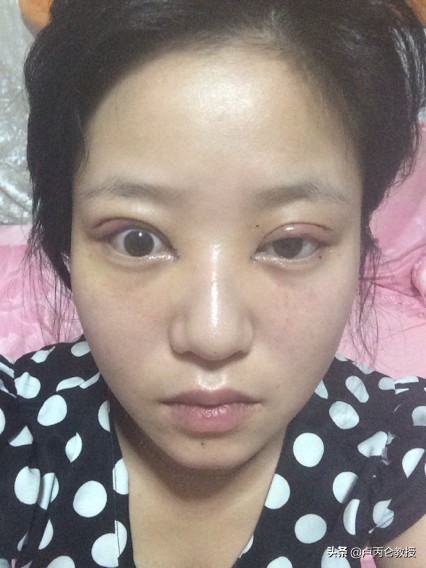 整形会有后遗症吗？为什么整形会上瘾