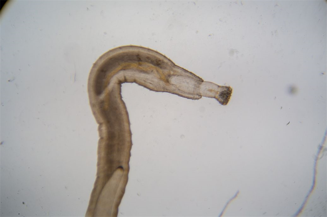 如果把水蛭吃进肚子会怎样,水蛭会不会寄生在身体里呢