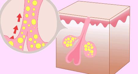 拒绝油腻告别老气,拒绝油腻