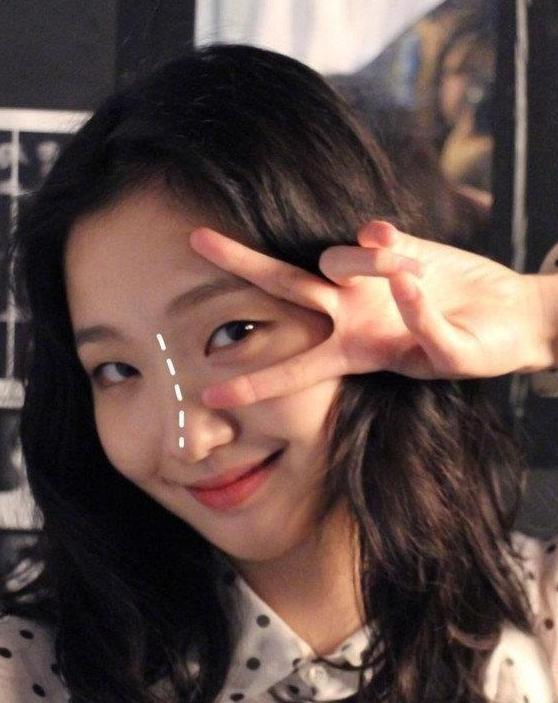 塌鼻子蒜头鼻瘦下来能好看吗,塌鼻梁蒜头鼻侧脸为什么会很丑