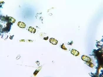 水产养殖藻类老化是怎样的,水产养殖显微镜下各种藻类