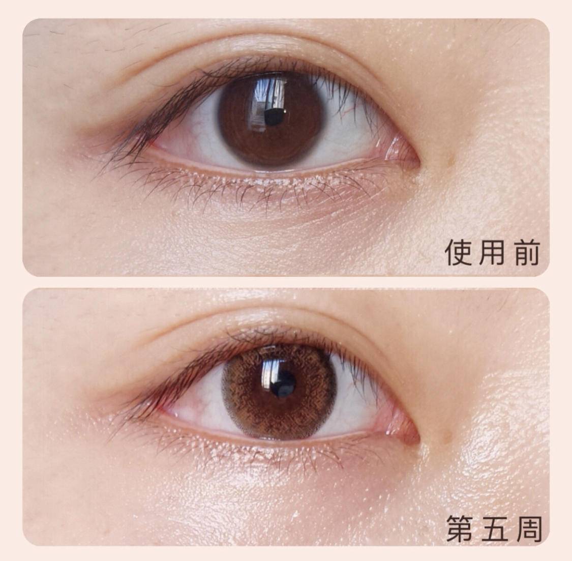 有句话说得好：美不美看脸，老不老看眼