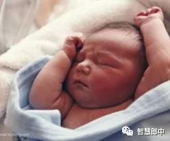 新生儿的几种生理现象图片,新生儿正常生理现象