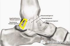 打篮球崴脚怎么处理热敷还是冷敷,崴脚超过48小时是热敷还是冷敷