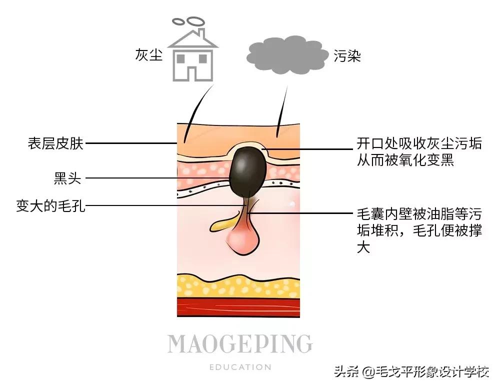 如何去黑头最快最有效的方法,科颜氏白泥去黑头正确使用方法