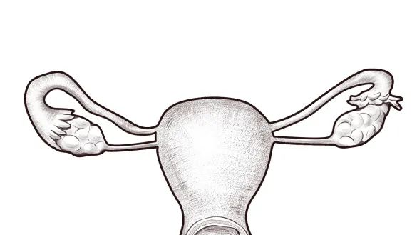 子宫偏小不治疗怀孕容易流产,子宫偏小容易流产怎么办