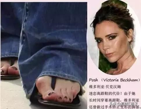 贝克汉姆大儿子利物浦,贝克汉姆大儿子是驼背吗