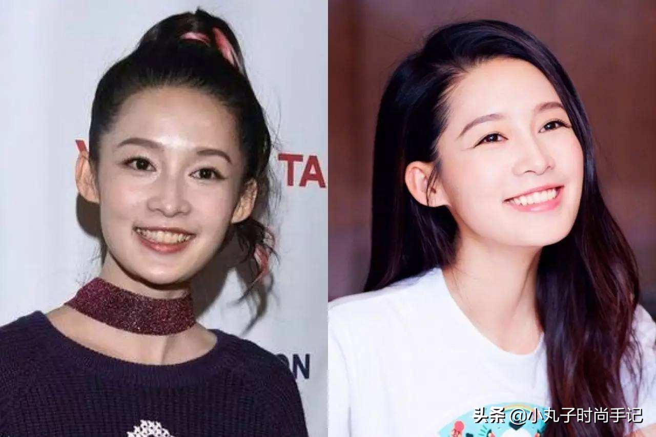 李沁牙膏真的有效果吗,李沁的黄牙变白了