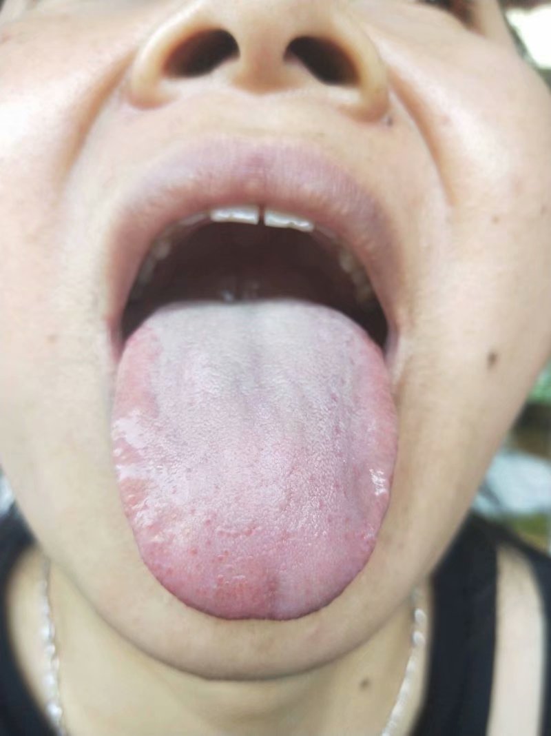 师说阅读参考答案,从舌象看妇科病