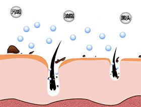 别挤了教你去黑头的正确方法,黑头用黑头膏为什么去不掉黑头