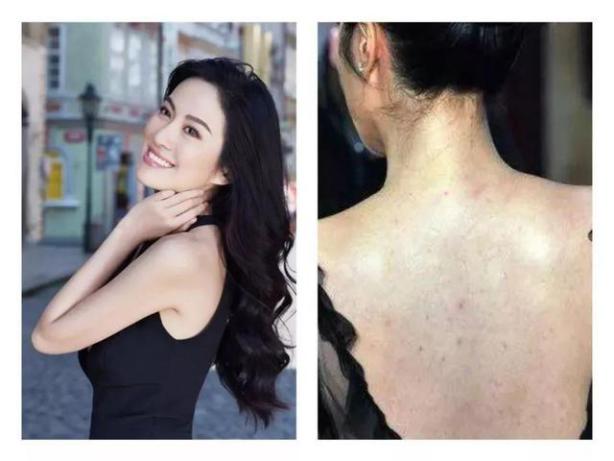 日本去螨虫皂,日本小黑皂号称螨虫克星