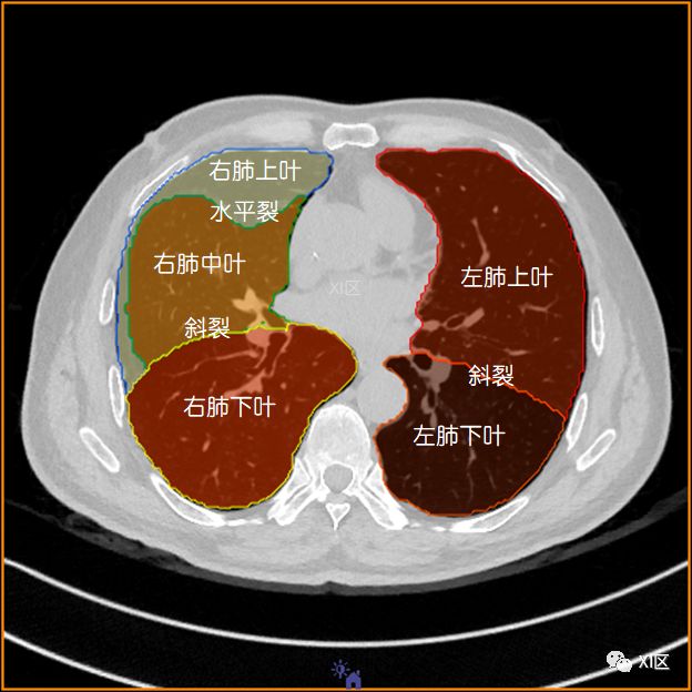如此详细的肺部影像解剖，有点儿酷