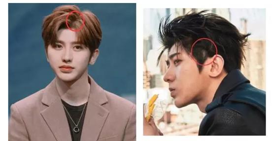 怎么护理头发干枯毛躁掉发,如何护理干枯分叉的头发