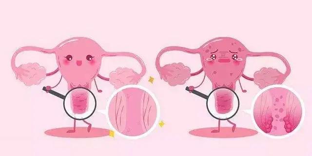 经期过后5天又有出血现象,不在经期内出血可能是怀孕吗