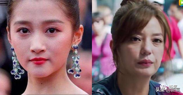 关晓彤怎样去泪沟,关晓彤眼袋去除视频