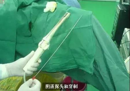 拜金的代价，花季少女堕落史！揭开捐卵黑中介的诡计