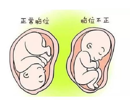 孕期霉菌性炎症需要注意什么,孕期做糖耐需要注意什么