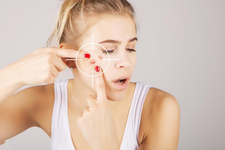 全网寻求祛除痘印好办法,全球公认祛痘印的方法