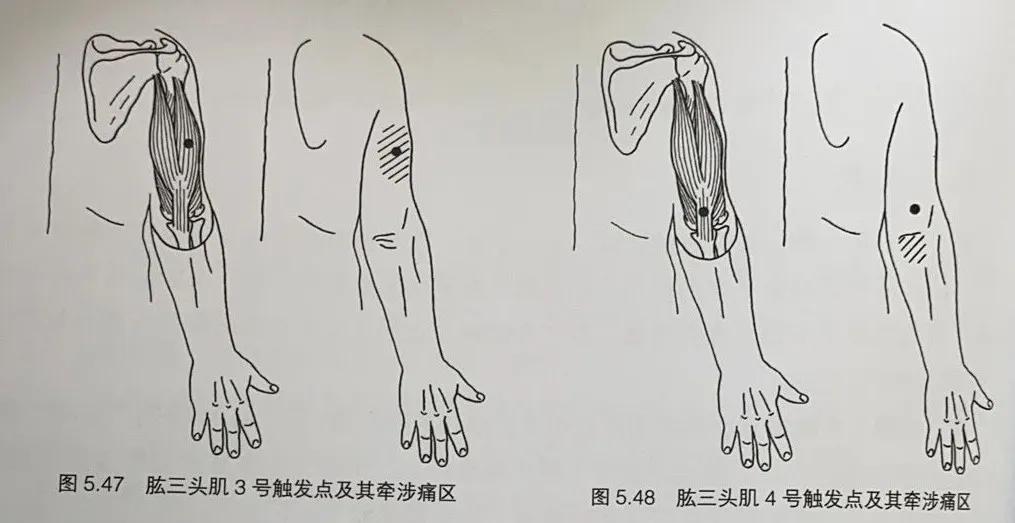 专业解决各种疼痛治疗效果好吗,专业疼痛调理