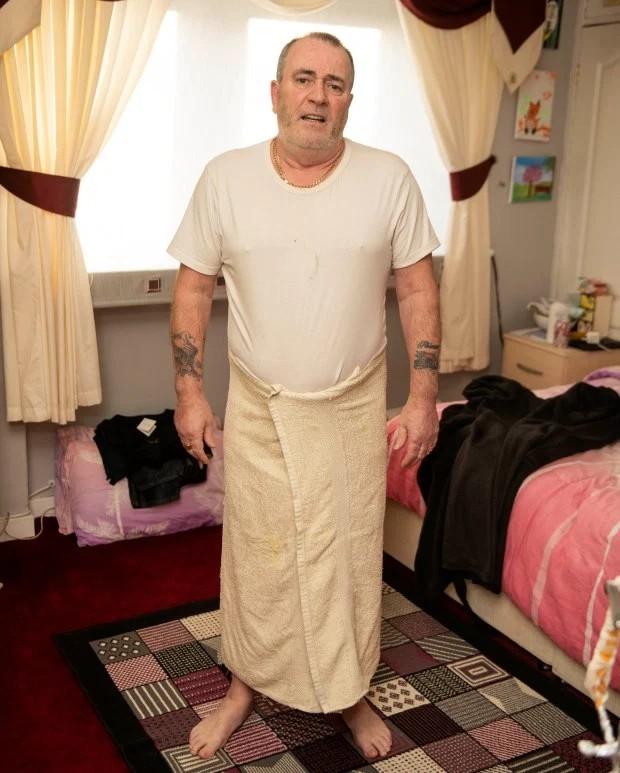 英国男子因手术后遗症生殖器无法软化穿裤子剧痛不能出门