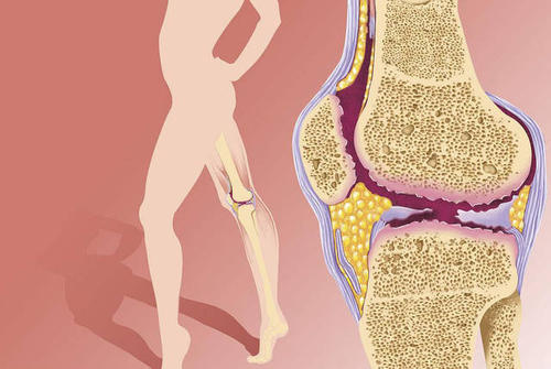 为什么缺乏维生素b会口腔溃疡,口腔溃疡是缺乏维生素什么导致的