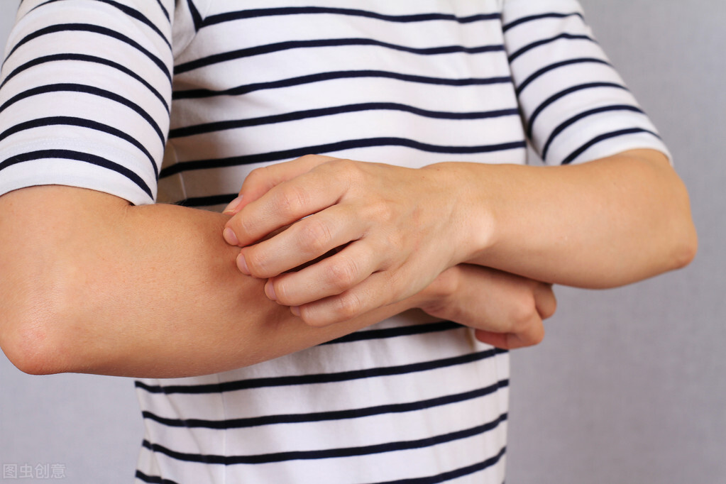 肛周湿疹老反复怎样才能彻底治愈,想彻底治疗湿疹