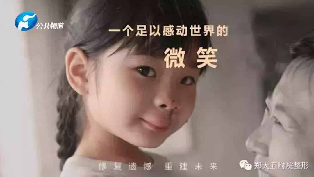 郑州中心医院整形美容外科怎么样,郑州大学第一附属医院整形美容科