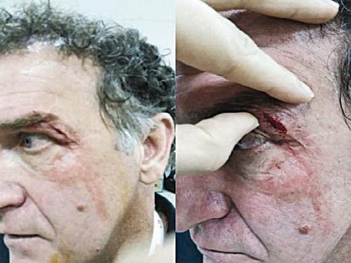 挥之不去的梦魇完整版,挥之不去的梦魇全集