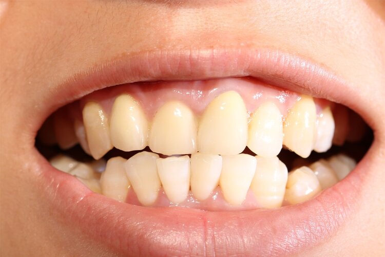 老中医治牙妙招,牙齿再生民间名老中医秘方