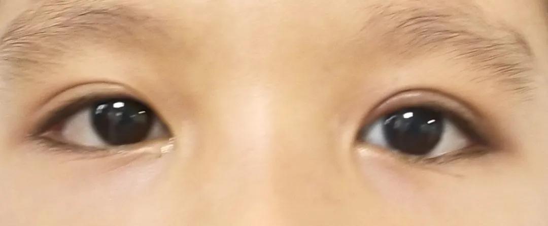 3岁小孩平时爱挑眉、耸肩，医生却说不是坏习惯？