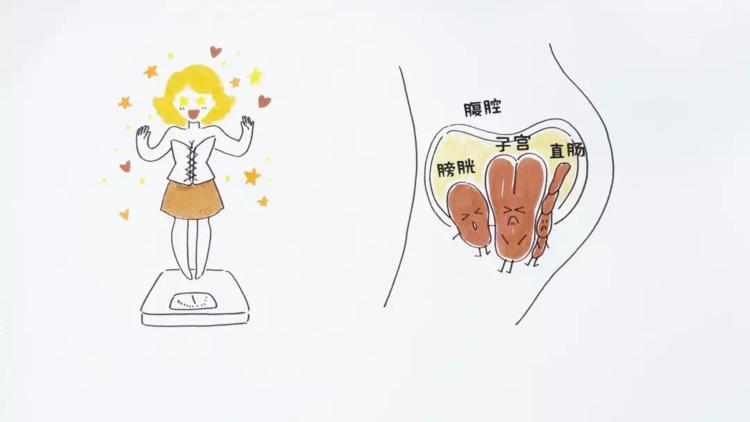 盆底康复不能拖到二胎再做
