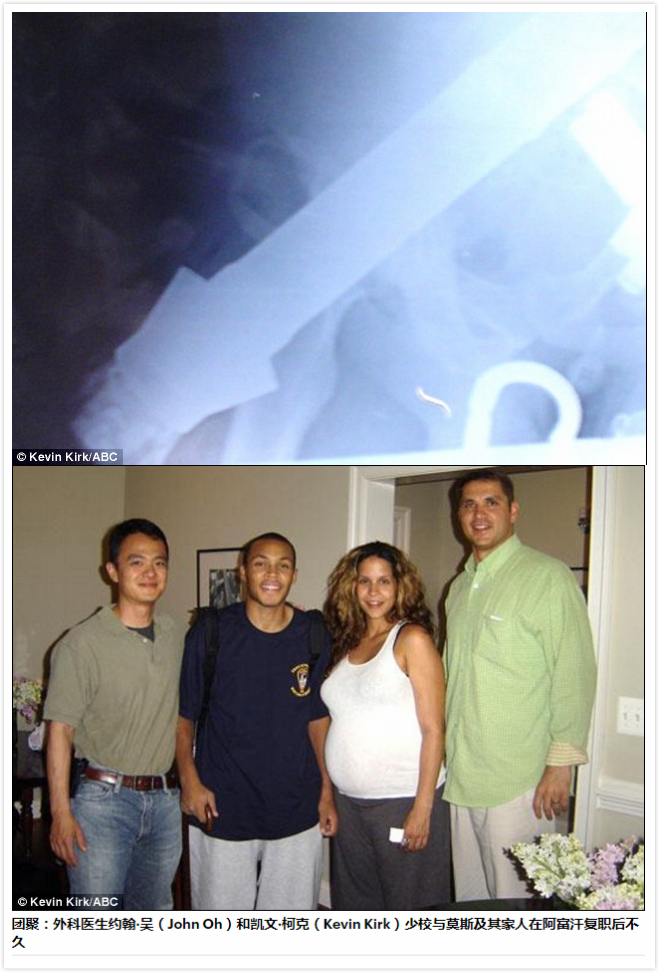 迫击炮真实战争,迫击炮rpg