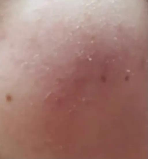 精华液护肤步骤及使用方法,保湿精华液怎么用效果最好