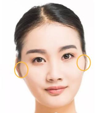 颧骨高面部填充好还是内推好,改善颧骨宽大