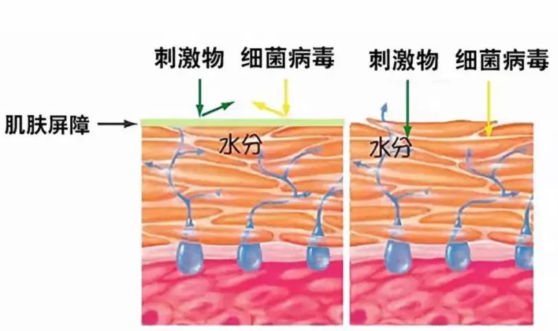 角质层薄脸上有红血丝怎么调理,角质层薄有红血丝脸发红怎么修复