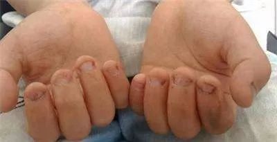 咬衣服的孩子危害,三四岁的小孩咬手咬衣服心理学