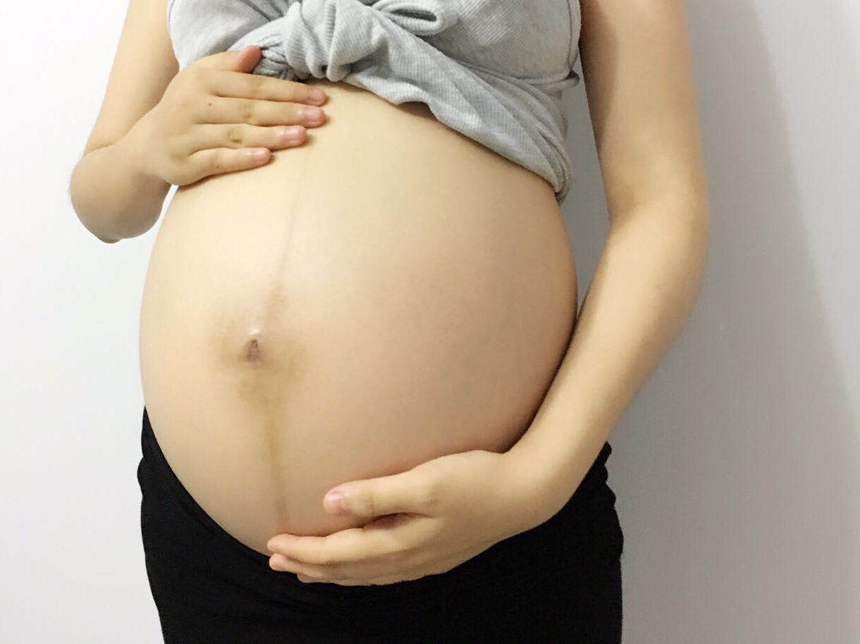 最好用的防妊娠纹产品,妊娠纹修复霜可以预防孕纹吗