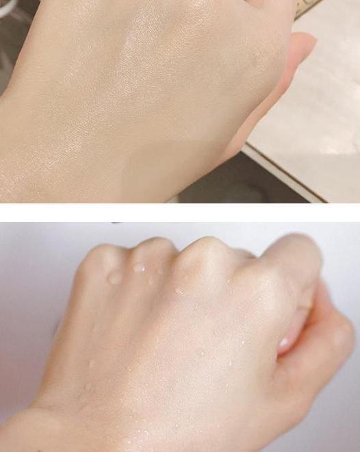 闭口粉刺去美容院清闭口好吗,如何正确去除粉刺闭口