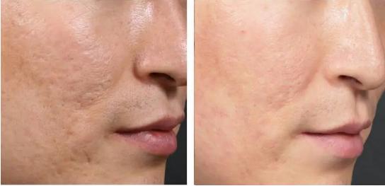 值得做的医美项目有哪些,哪些值得做的医美项目