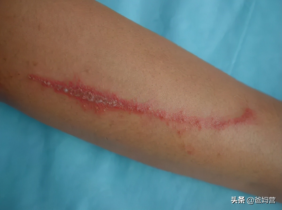 妈妈一拍小孩差点毁容,妈妈拍到孩子的恐怖画面