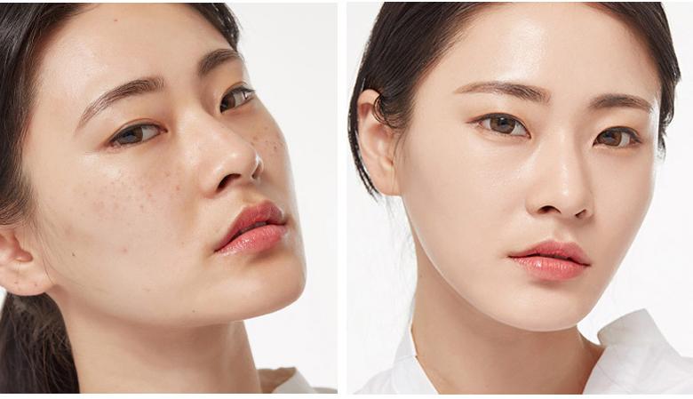 男生怎么缩小毛孔,毛孔缩小的过程图