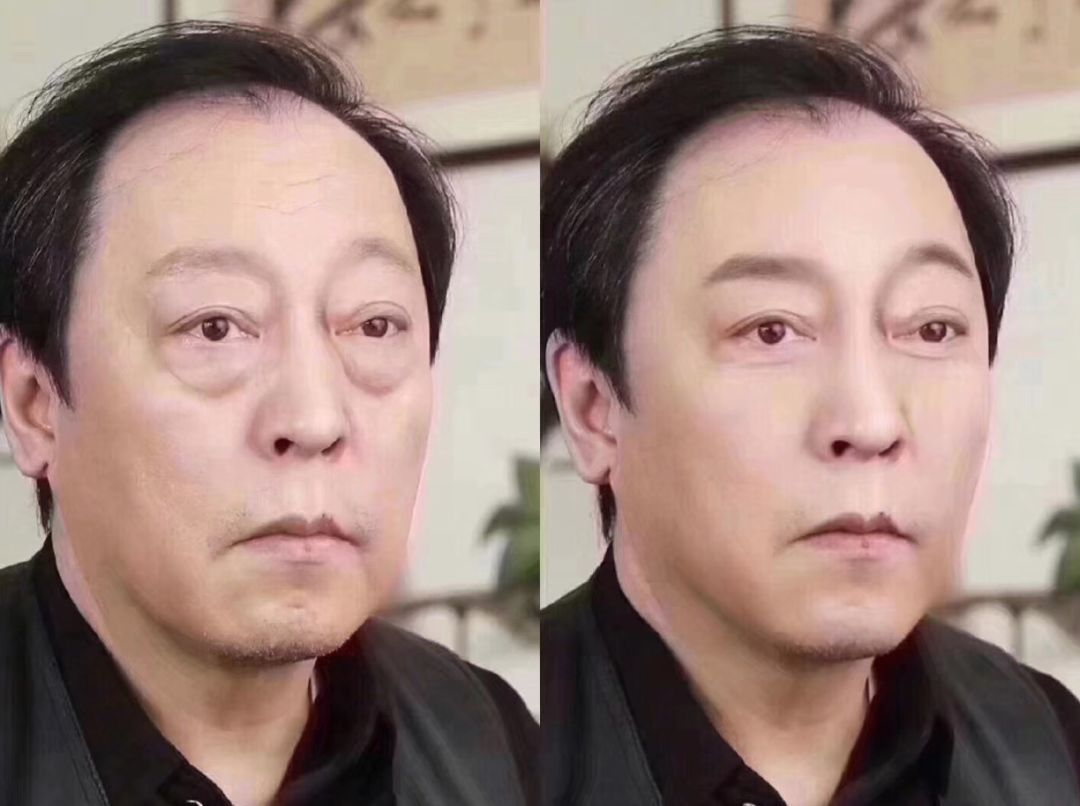 眼袋和卧蚕有什么区别怎么祛眼袋,一招教你怎么判断眼袋还是卧蚕