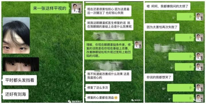 高难度双眼皮修复：那些被判死刑的失败双眼皮最后都怎样了？