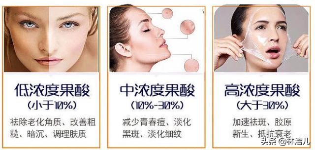 刘雨昕怕长痘吗,刘雨昕长痘的原因