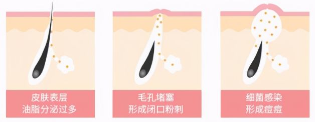 男士护肤推荐套装油痘肌平价,男士控油收缩毛孔护肤品测评推荐