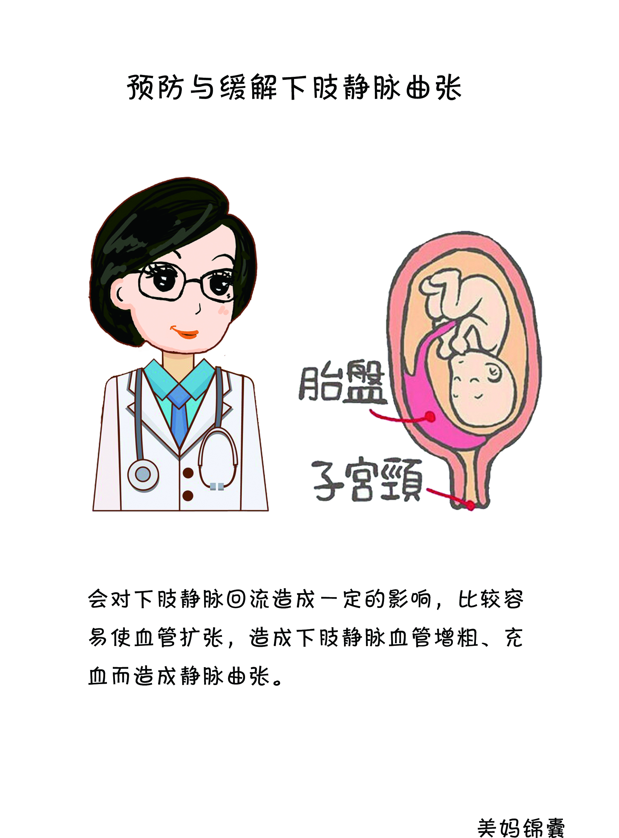 孕妇怎么预防下肢静脉曲张,孕期怎么注意静脉曲张的症状