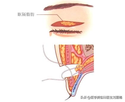 尚雯婕单眼皮吗,尚雯婕参加王牌视频